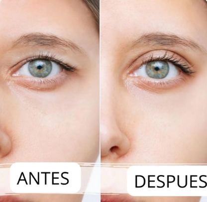 EYELID® LEVANTA PÁRPADOS